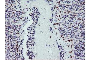 Image no. 1 for anti-BTB and CNC Homology 1, Basic Leucine Zipper Transcription Factor 1 (BACH1) antibody (ABIN1496803) (BACH1 Antikörper)