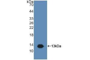 Figure. (CD81 Antikörper  (AA 113-201))