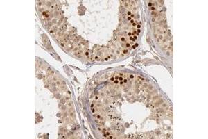 Immunohistochemical staining of human testis with CTCFL polyclonal antibody  shows strong nuclear positivity in primary spermatocytes. (CTCFL Antikörper)
