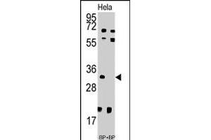 Western blot analysis of UCK2 polyclonal antibody  pre-incubated with and without blocking peptide (BP7192a) in HeLa cell line lysate. (UCK2 Antikörper  (N-Term))