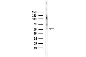 Western blot analysis of lysates from Rat testis, using Phospho-PDC (Ser457) Antibody at 1/1000 dilution.