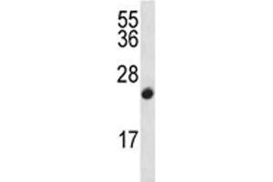 CDKN2B antibody western blot analysis in CEM lysate (CDKN2B Antikörper  (AA 103-131))