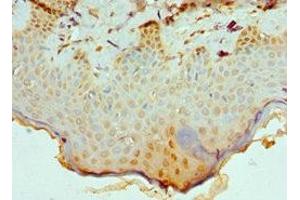 Immunohistochemistry of paraffin-embedded human skin tissue using ABIN7147709 at dilution of 1:100 (CBX8 Antikörper  (AA 80-280))