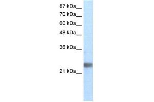 Transfected 293T; WB Suggested Anti-ZNF313 Antibody Titration: 1. (RNF114 Antikörper  (N-Term))