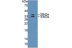 Western Blotting (WB) image for anti-Microtubule Associated Tumor Suppressor 1 (MTUS1) (AA 1018-1270) antibody (ABIN7444805)