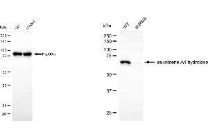 Western blotting analysis using leukotriene A4 hydrolase antibody (ABIN7799259). (LTA4H Antikörper)
