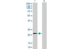 Western Blot analysis of MRPL11 expression in transfected 293T cell line by MRPL11 MaxPab polyclonal antibody. (MRPL11 Antikörper  (AA 1-192))