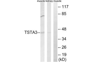 Western blot analysis of extracts from rat kidney cells and rat muscle cells, using TSTA3 antibody. (TSTA3 Antikörper  (C-Term))