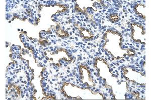 Rabbit Anti-MUC1 Antibody       Paraffin Embedded Tissue:  Human alveolar cell   Cellular Data:  Epithelial cells of renal tubule  Antibody Concentration:   4. (MUC1 Antikörper  (C-Term))
