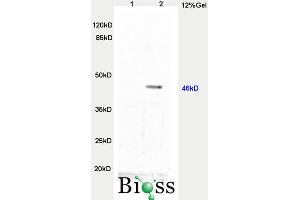 L1 rat brain, L2 human colon carcinoma lysates probed  at 1:3000 90min in 37˚C. (TWIST1, TWIST2 (AA 71-170) Antikörper)