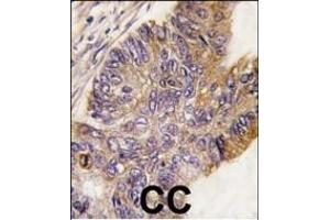 Immunohistochemistry (Paraffin-embedded Sections) (IHC (p)) image for anti-Ribosomal Protein S6 Kinase, 90kDa, Polypeptide 1 (RPS6KA1) (AA 710-735) antibody (ABIN392452)