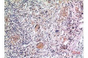 Immunohistochemistry (IHC) image for anti-NLR Family, Pyrin Domain Containing 3 (NLRP3) (Internal Region) antibody (ABIN6287297)