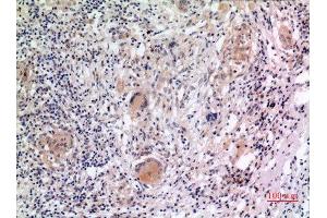 Immunohistochemistry (IHC) analysis of paraffin-embedded Human Lung, antibody was diluted at 1:100. (NLRP3 Antikörper  (Internal Region))