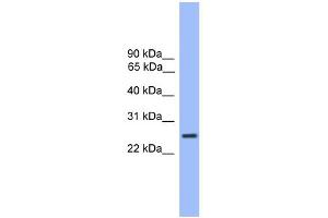 WB Suggested Anti-GOSR1 Antibody Titration: 0. (GS28 Antikörper  (C-Term))