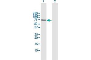 Western Blot analysis of PIAS2 expression in transfected 293T cell line by PIAS2 MaxPab polyclonal antibody. (PIAS2 Antikörper  (AA 1-572))