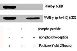 Western Blot analysis of various cells using Phospho-PPAR-γ (S112) Polyclonal Antibody (PPARG Antikörper  (pSer112))