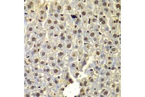 Immunohistochemistry of paraffin-embedded mouse liver using SSX5 antibody at dilution of 1:100 (x400 lens).