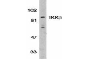 Western blot analysis of IKK beta in Jurkat whole cell lysate with AP30406PU-N IKK beta antibody (C3) at 1/500 dilution. (IKBKB Antikörper  (C-Term))