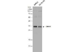 WB Image SNAI1 antibody detects SNAI1 protein by western blot analysis. (SNAIL Antikörper)