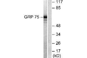 Western blot analysis of extracts from COS7 cells, using GRP75 antibody (#C0216). (HSPA9 Antikörper)