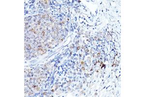 Immunohistochemistry (IHC) image for anti-BCL2-Related Ovarian Killer (BOK) (AA 1-100) antibody (ABIN7265866)