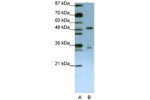 WB Suggested Anti-UPF3B Antibody Titration:  1. (UPF3B Antikörper  (N-Term))