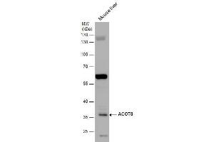 WB Image ACOT8 antibody detects ACOT8 protein by western blot analysis. (ACOT8 Antikörper)