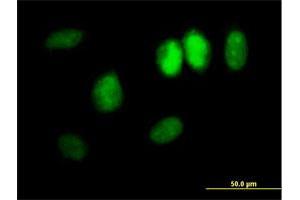 Immunofluorescence of purified MaxPab antibody to DDX11 on HeLa cell. (DDX11 Antikörper  (AA 1-970))