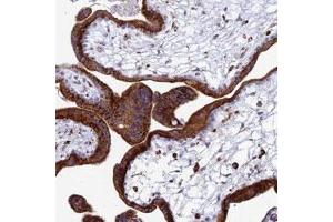 Immunohistochemical staining of human placenta with SPNS1 polyclonal antibody  shows strong cytoplasmic positivity in trophoblastic cells. (SPNS1/Spinster 1 Antikörper)