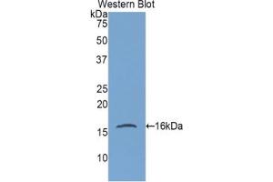 Western blot analysis of the recombinant protein. (Gastrokine 1 Antikörper  (AA 27-151))