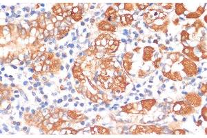 Immunohistochemistry of paraffin-embedded Human stomach using HHLA2 Polyclonal Antibody at dilution of 1:100 (40x lens). (HHLA2 Antikörper)