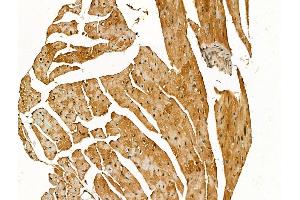 ABIN7094472 and ABIN7098520 at 1/100 staining Mouse heart tissue by IHC-P.