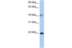 WB Suggested Anti-DLX4 Antibody Titration:  0.