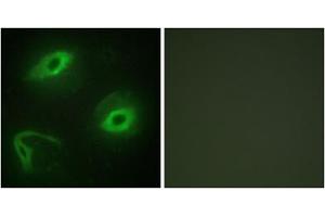 Immunofluorescence analysis of HeLa cells, using LATH antibody. (LATH Antikörper  (Internal Region))