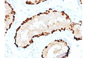 Formalin-fixed, paraffin-embedded human Testis stained with MAGEA4 Mouse Monoclonal Antibody (CPTC-MAGEA4-1). (MAGEA4 Antikörper)
