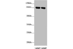 Western blot All lanes: NDUFS1 antibody at 2. (NDUFS1 Antikörper  (AA 80-290))