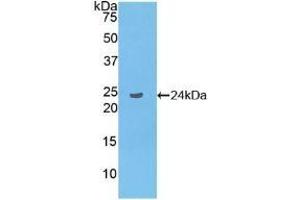 Detection of Recombinant LAT2, Human using Polyclonal Antibody to Linker For Activation Of T-Cells Family, Member 2 (LAT2) (LAT2 Antikörper  (AA 30-209))