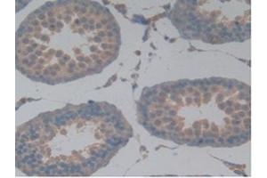 Detection of MAPT in Rat Testis Tissue using Polyclonal Antibody to Tau Protein (MAPT) (tau Antikörper  (AA 34-368))