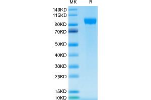 ErbB2/Her2 Protein (AA 23-652) (His-Avi Tag)