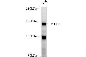 Western blot analysis of extracts of HEL cells, using PLCB2 antibody (ABIN6133052, ABIN6145747, ABIN6145748 and ABIN6224164) at 1:1000 dilution. (Phospholipase C beta 2 Antikörper  (AA 1-199))
