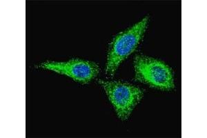 Fluorescent confocal image of HeLa cells stained with anti-Alkaline Phosphatase antibody at 1:100. (Alkaline Phosphatase Antikörper  (AA 274-304))