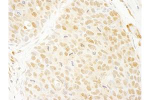 anti-Ankyrin Repeat Domain 17 (ANKRD17) (AA 1550-1600) antibody