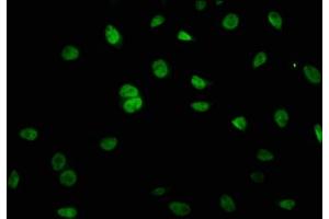 Immunofluorescence staining of A549 cells with ABIN7158687 at 1:66, counter-stained with DAPI. (KRCC1 Antikörper  (AA 1-259))