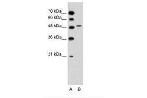 Image no. 2 for anti-Solute Carrier Family 10 (Sodium/bile Acid Cotransporter Family), Member 5 (SLC10A5) (AA 351-400) antibody (ABIN205007) (SLC10A5 Antikörper  (AA 351-400))