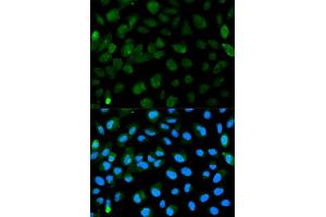 Immunofluorescence analysis of HeLa cell using PML antibody. (PML Antikörper)