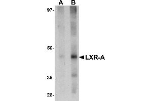 Western Blotting (WB) image for anti-Nuclear Receptor Subfamily 1, Group H, Member 3 (NR1H3) (N-Term) antibody (ABIN1031443) (NR1H3 Antikörper  (N-Term))
