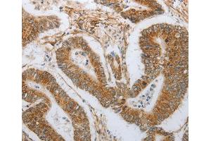 Immunohistochemistry (IHC) image for anti-Neurogenin 1 (NEUROG1) antibody (ABIN6220067) (Neurogenin 1 Antikörper)