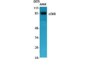 Western Blot (WB) analysis of specific cells using cGKII Polyclonal Antibody. (PRKG2 Antikörper  (Internal Region))
