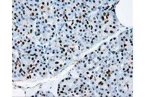 Immunohistochemical staining of paraffin-embedded colon tissue using anti-RPA2mouse monoclonal antibody. (RPA2 Antikörper)