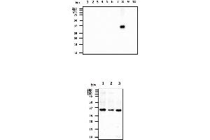 The recombinant proteins (20ng) were resolved by SDS-PAGE, transferred to PVDF membrane and probed with anti-human CTSS antibody (1:1000). (Cathepsin S Antikörper)